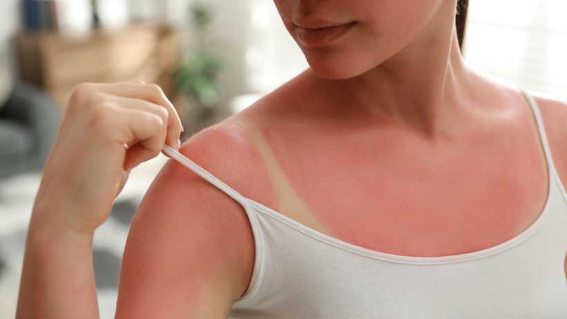 How To Get Rid Of Tanning Naturally?
