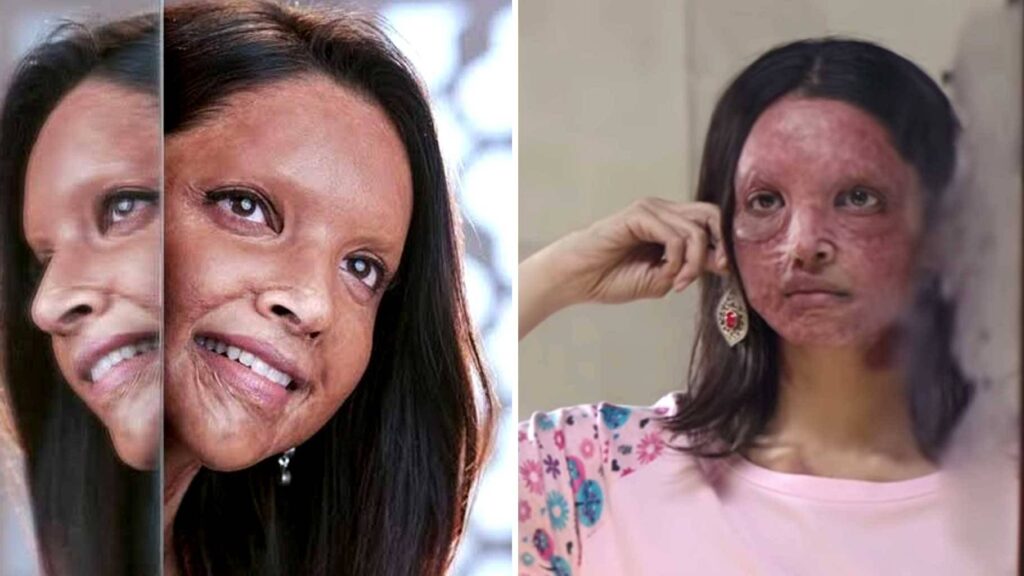 Chhapaak Film Famous Quotes