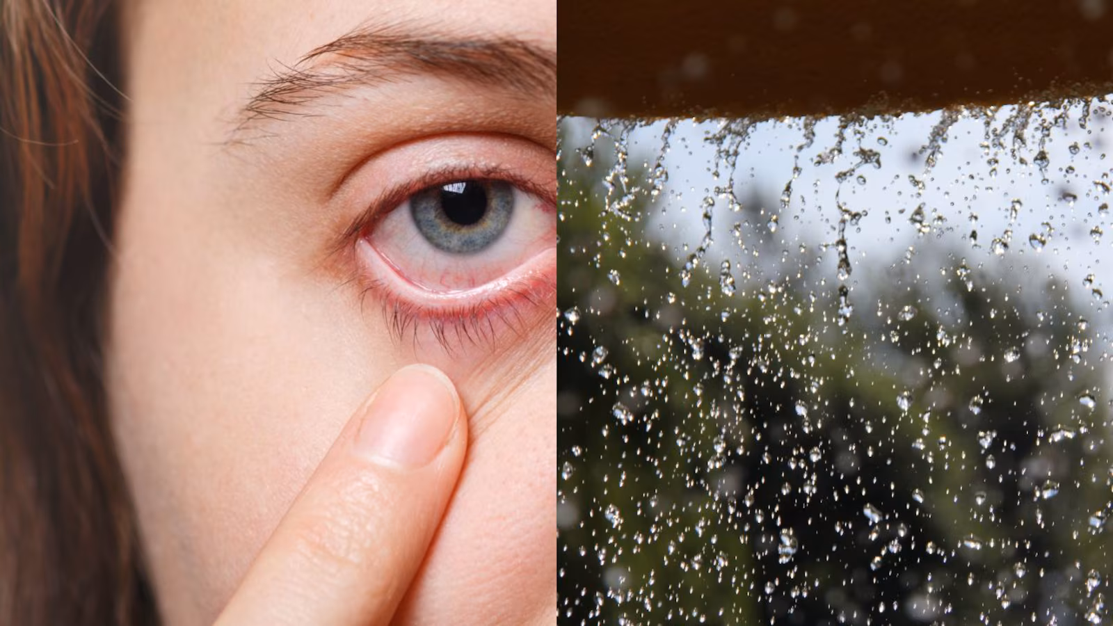 Tips To Avoid Eye Infections During Monsoon