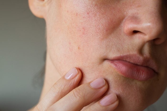 Your Face Reveals Your Health: 10 Facial Signs You Should Never Ignore